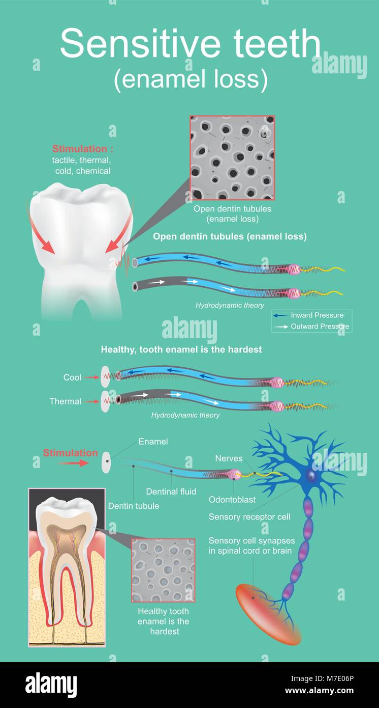 Sensible Dental ist so intensiv und vorübergehende Schmerzen, die sich durch die Exposition der Dentin definiert. Vektor Grafik Design. Stock Vektor