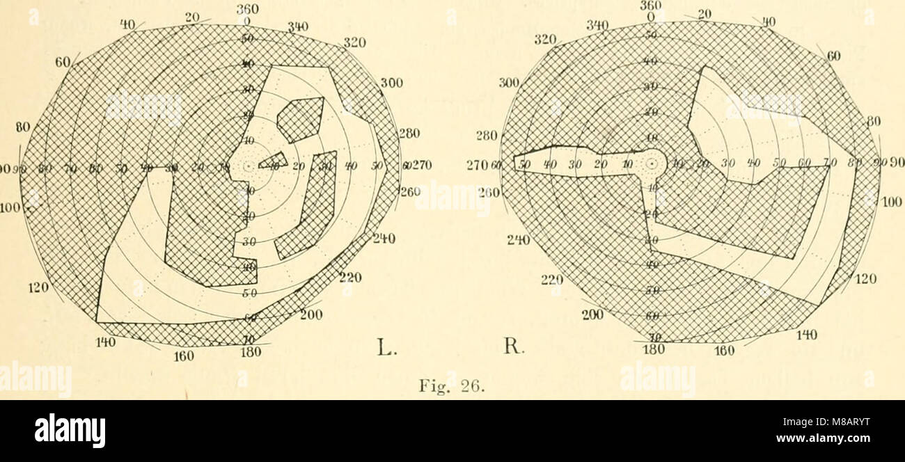 Die Neurologie des Auges. Ein Handbuch für Nerven- und Augenärzte (1900) (14783672575) Stockfoto