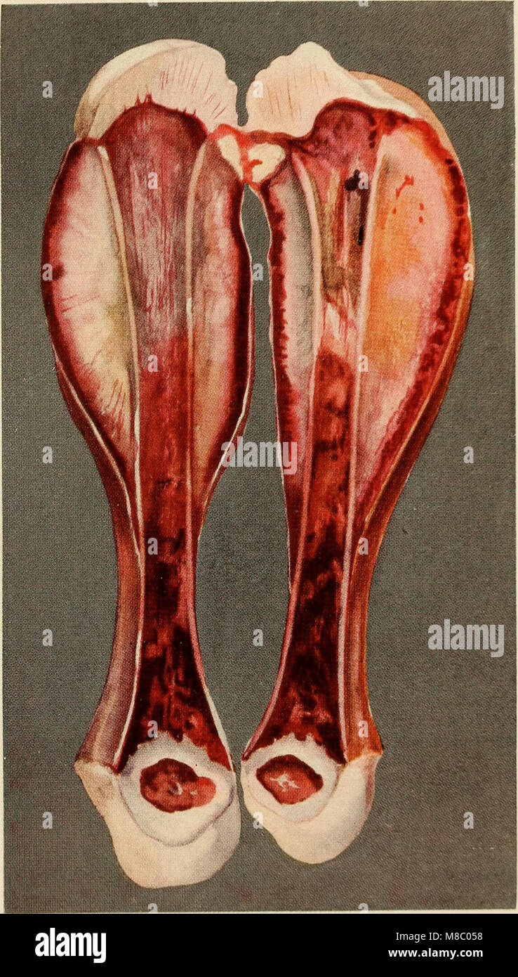 „Erkrankungen des Säuglings und der Kindheit“ (1914) bietet einen umfassenden Überblick über allgemeine Erkrankungen, die Säuglinge und Kinder betreffen, wobei der Schwerpunkt auf Prävention, Diagnose und Behandlung in der frühkindlichen Gesundheitsversorgung liegt. Stockfoto