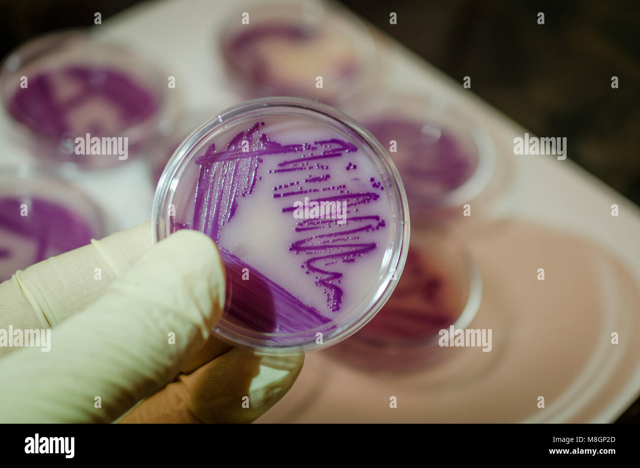 Bakterielle Kultur Platte in der Hand halten Stockfoto