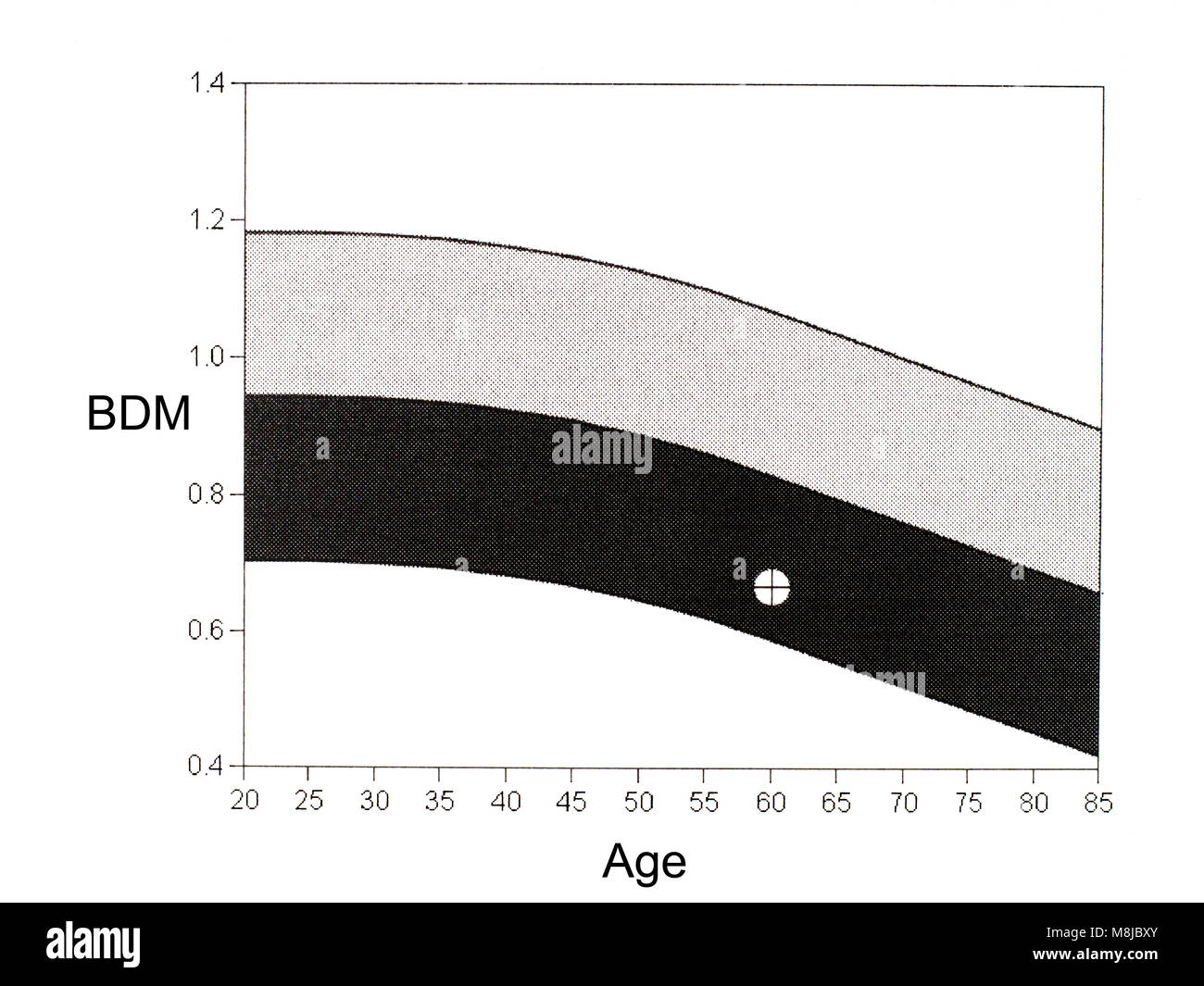 Die knochendichte von DEXA Scan. Medizintechnik, Diagnostik Osteopenie. Häufig Vorläufer zu Osteoporose. Stockfoto