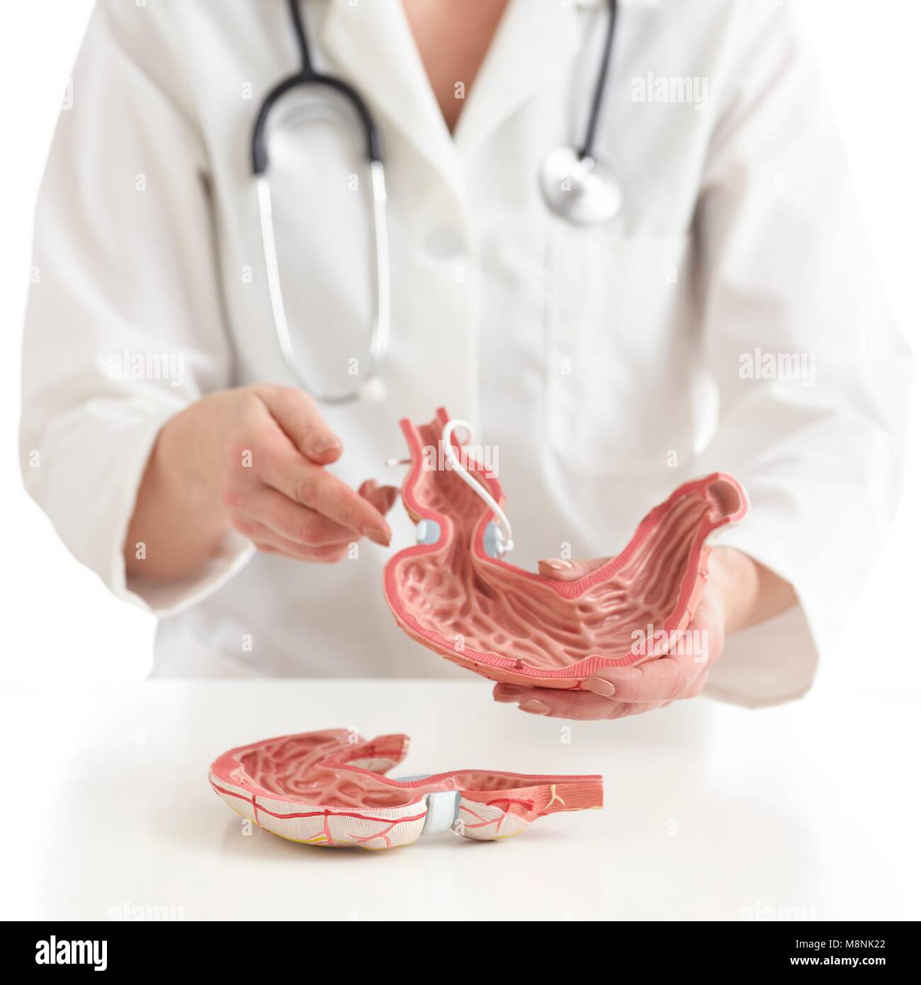 Arzt mit einem medizinischen Modell der menschlichen Magen mit einem gastrischen Band. Stockfoto