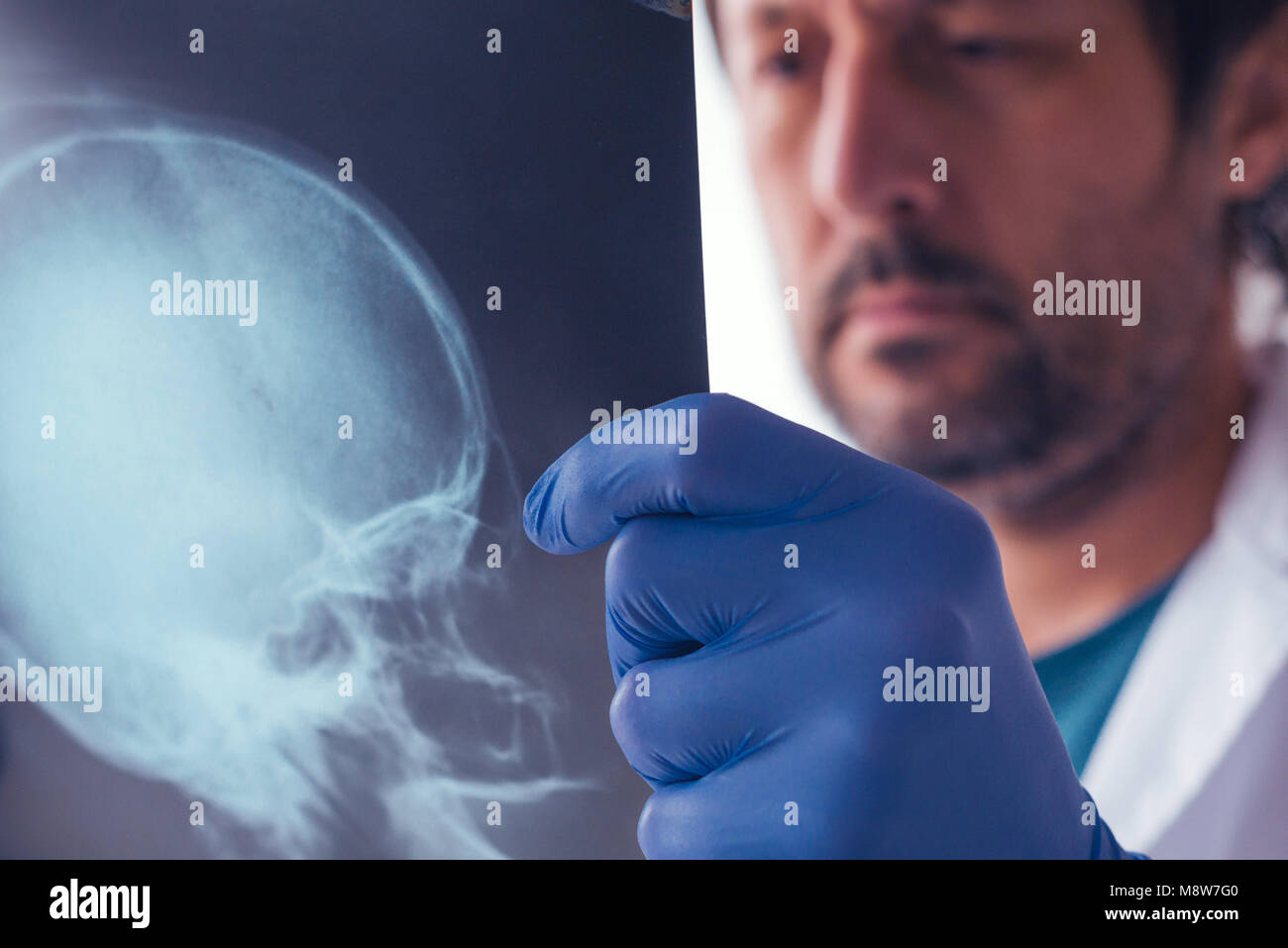 Arzt Prüfung x-ray der Schädel des Patienten in eine Klinik. Healthcare Professional Analyse imaging Test der menschlichen Kopf. Stockfoto