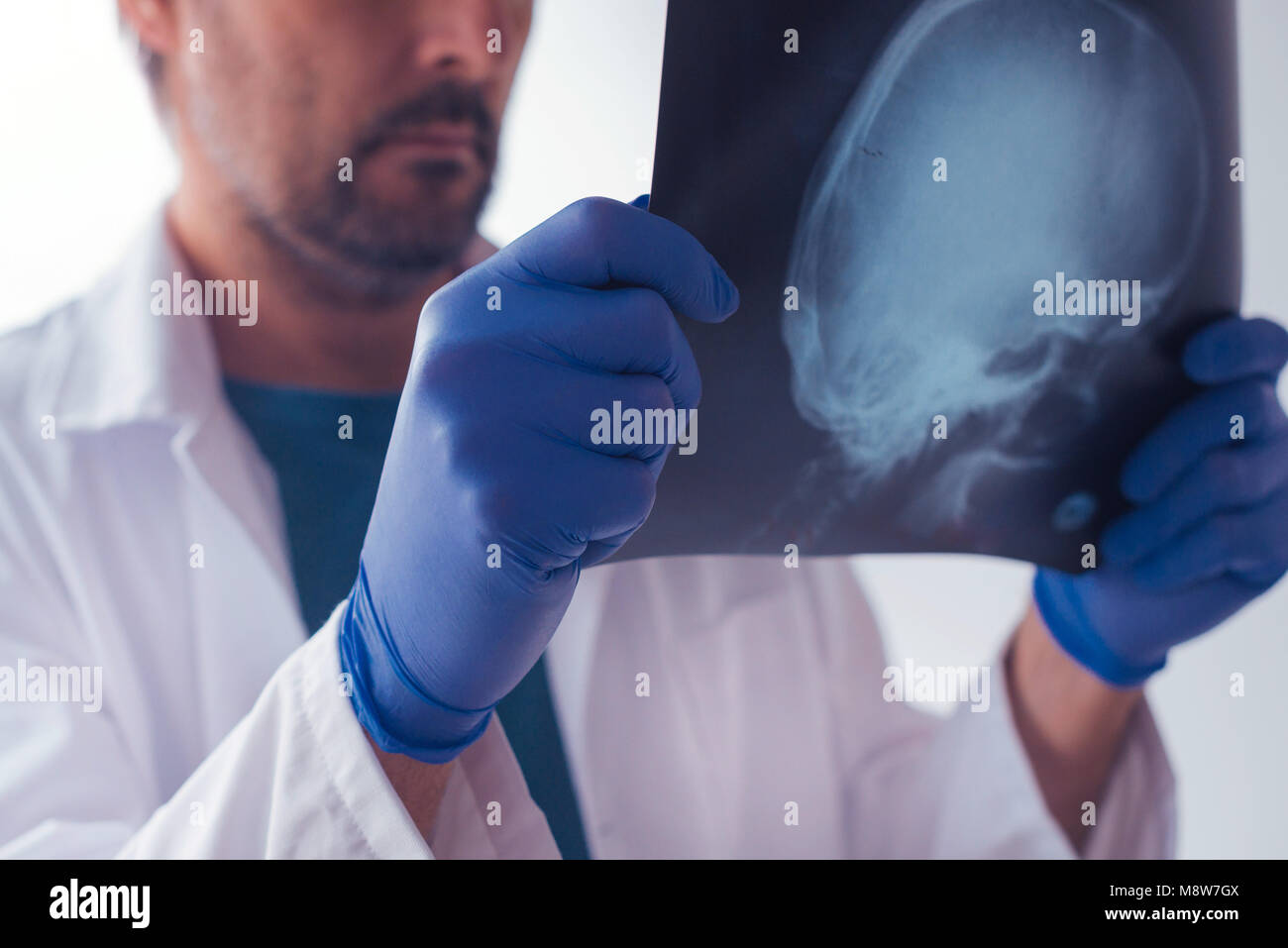 Arzt Prüfung x-ray der Schädel des Patienten in eine Klinik. Healthcare Professional Analyse imaging Test der menschlichen Kopf. Stockfoto