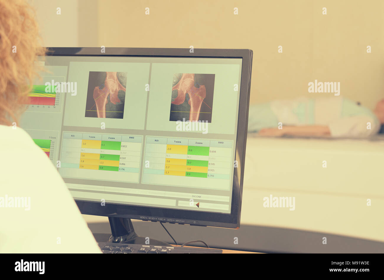 Eine Frau x-ray untersucht die Ergebnisse der Knochendichtemessung. Stockfoto