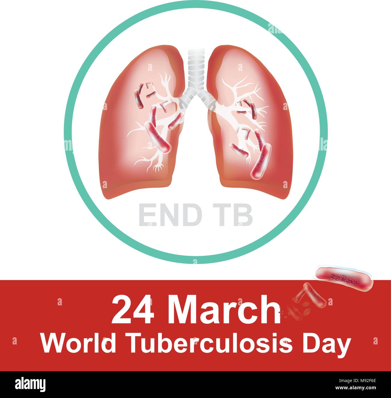 Patienten mit Infektionen der Atemwege. Durch Tuberkulose Bakterien verursacht. Tuberkulose Bakterien biss das Gewebe, was zu Lecks von Blutgefäßen. Il Stock Vektor