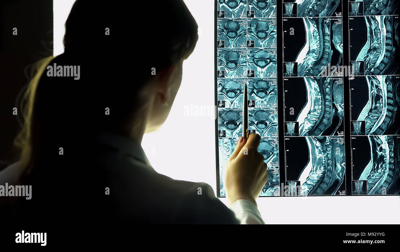 Ärztin auf Patient x-ray, ärztliche Untersuchung, Gesundheit Problem Stockfoto