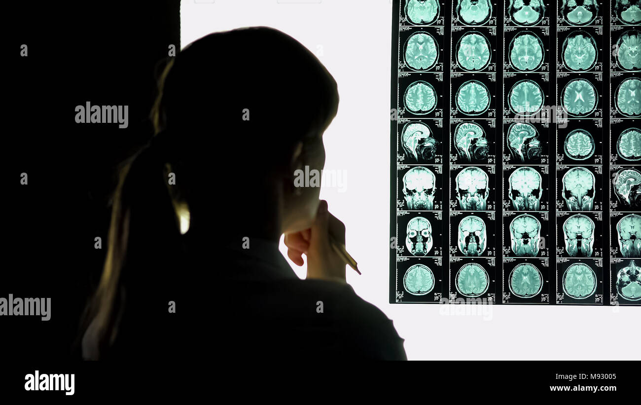 Nachdenklich Ärztin Analyse brain Scan, medizinische Forschung, schwierigen Fall Stockfoto