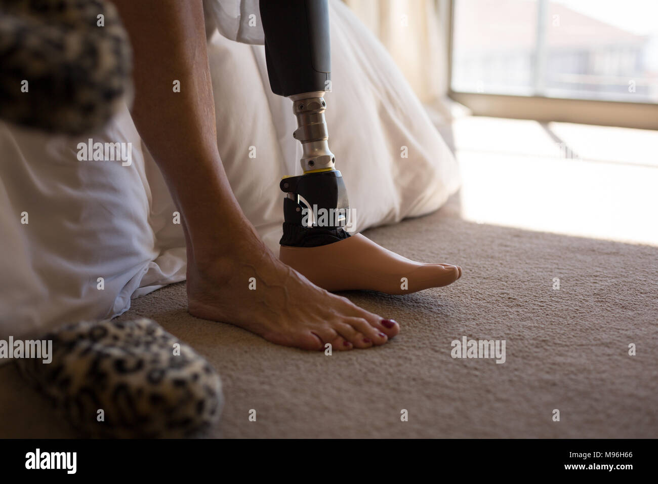 Frau mit beinprothese im Schlafzimmer zu Hause Stockfoto