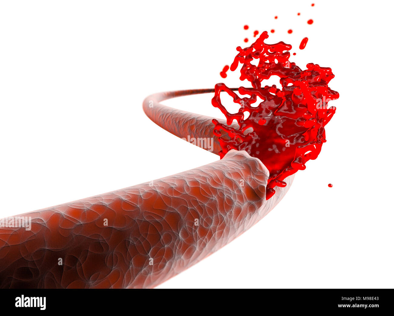 Vene, Arterie, Bruch Schneiden Blut Blutung. Innere Blutungen, Schnitt von einer Vene und Beenden von Blut Stockfoto