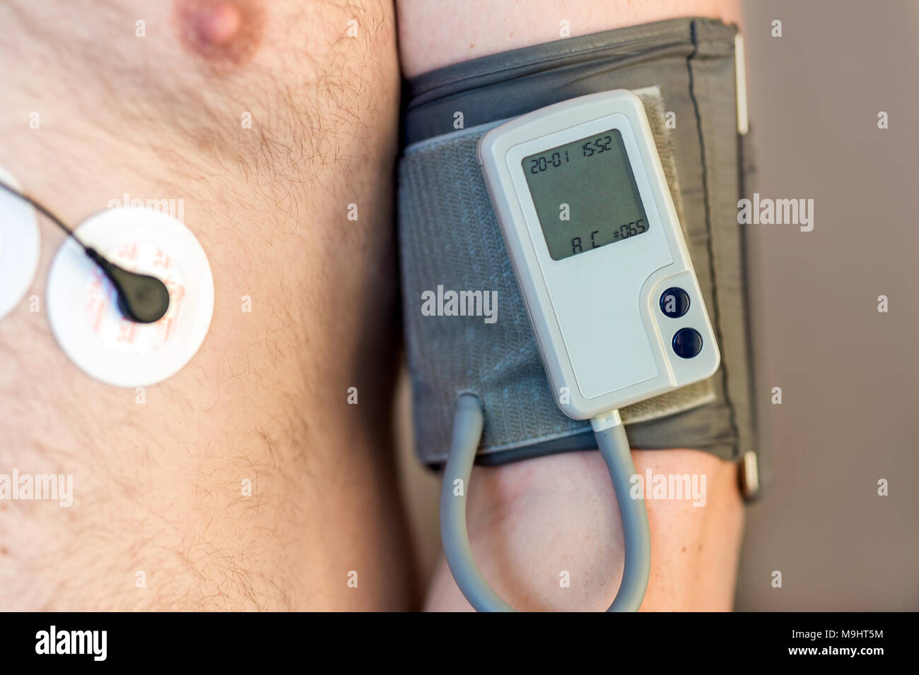 Holter Gerät überwachen und tägliche Blutdruck Recorder auf den männlichen Körper. Tägliche Elektrokardiogramm Überwachung. Übergewichtige Person. Hohes Risiko von kardialen Erkrankungen. Gesundheitsversorgung und Prävention Stockfoto