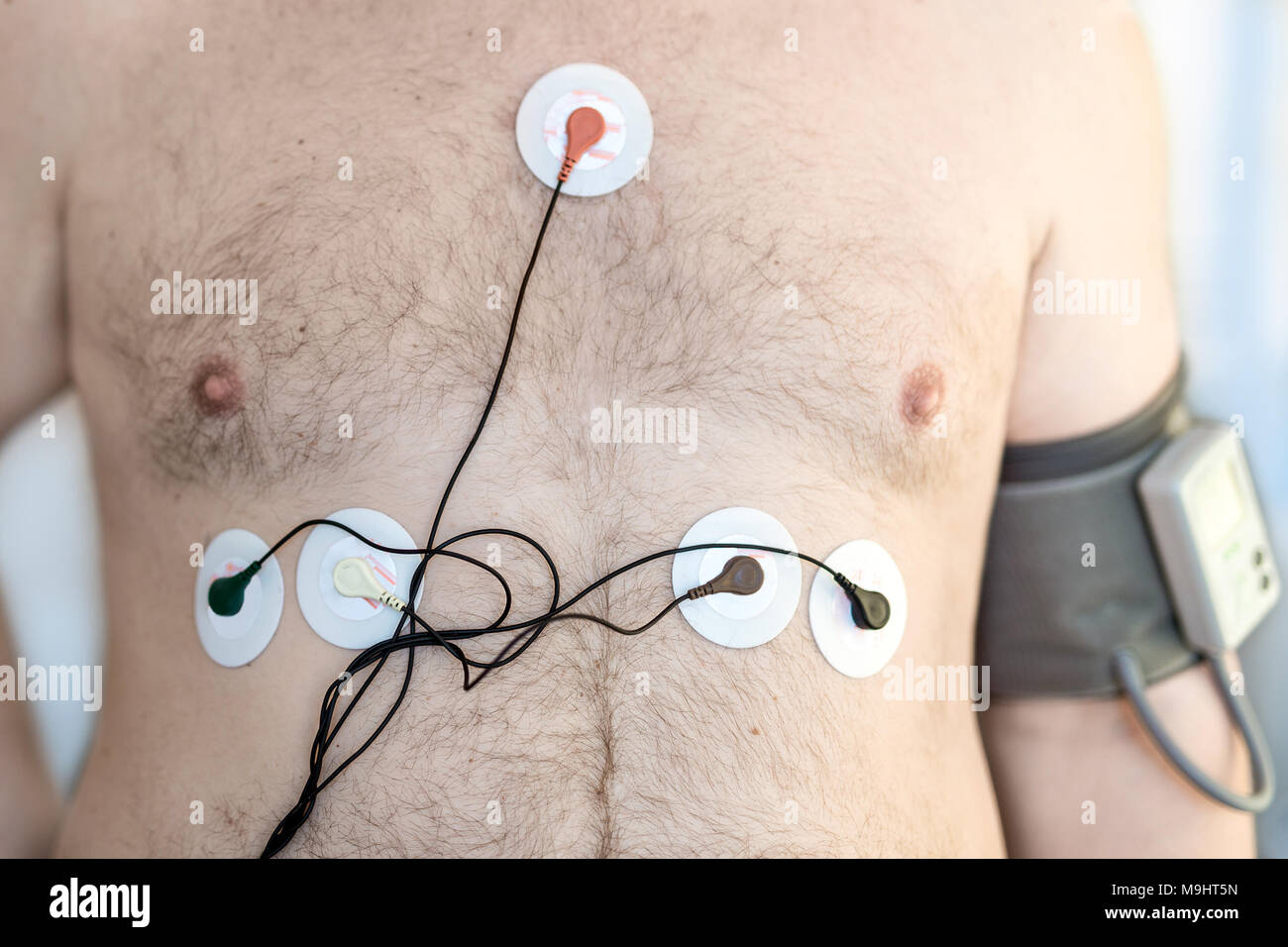 Holter Gerät überwachen und tägliche Blutdruck Recorder auf den männlichen Körper. Tägliche Elektrokardiogramm Überwachung. Übergewichtige Person. Hohes Risiko von kardialen Erkrankungen. Gesundheitsversorgung und Prävention Stockfoto
