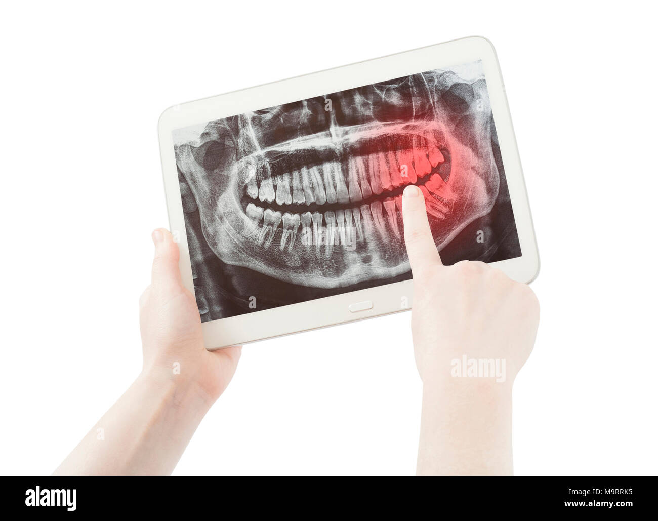 Hände sichtbar Schmerzen auf die Zähne Radiologie oder Radiographie und pc tablet Bildschirm isoliert auf weißem Stockfoto