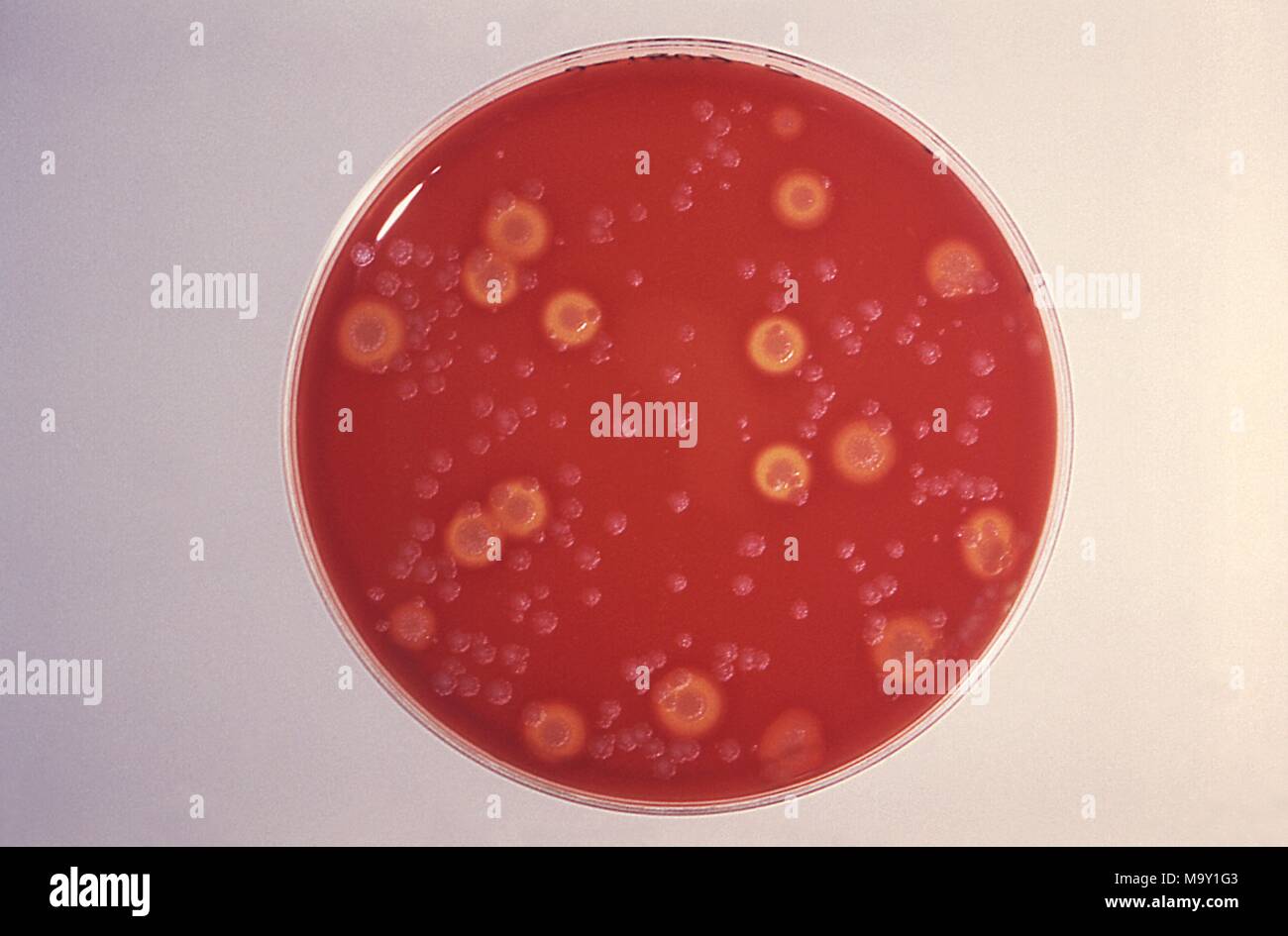 Blut agar wachsen Bacillus anthracis Kultur Platte und andere Boden Flora, 1980. Mit freundlicher Seuchenkontrollzentren (CDC)/Dr James Feely. Mit freundlicher CDC. () Stockfoto