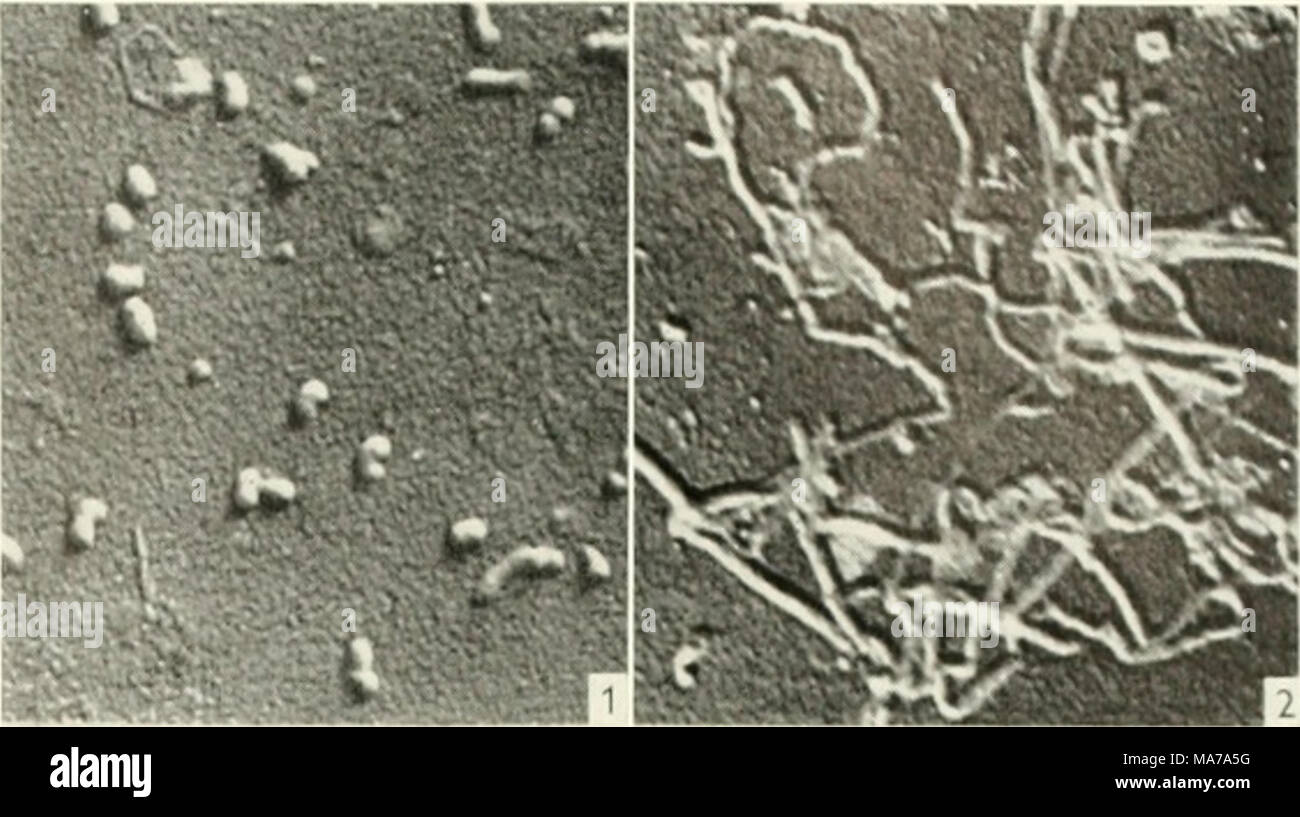 . Elektronenmikroskopie; Verfahren der Konferenz von Stockholm, September, 1956. Abb. 1. Belastung K.M. Typ A-1953. Vergrößerung 18.000. hig. 2. Belastung TM1. Geben Sie eine '-1954. Vergrößerung 1 1.000. In der "filamentösen" Belastungen die hämagglutinations-Titer der Infizierten allantois Flüssigkeit war sehr niedrig und lag zwischen 1:40 bis 1:160. Obwohl die morphologische Muster der "LAK" Belastung nach dem 1. und 15 Passagen anders war, keine diflerence wurde in der antigene Struktur etabliert. Die "filamentösen "Belastungen des Virus zeigen die starken Polymorphismus. Zusätzlich t Stockfoto