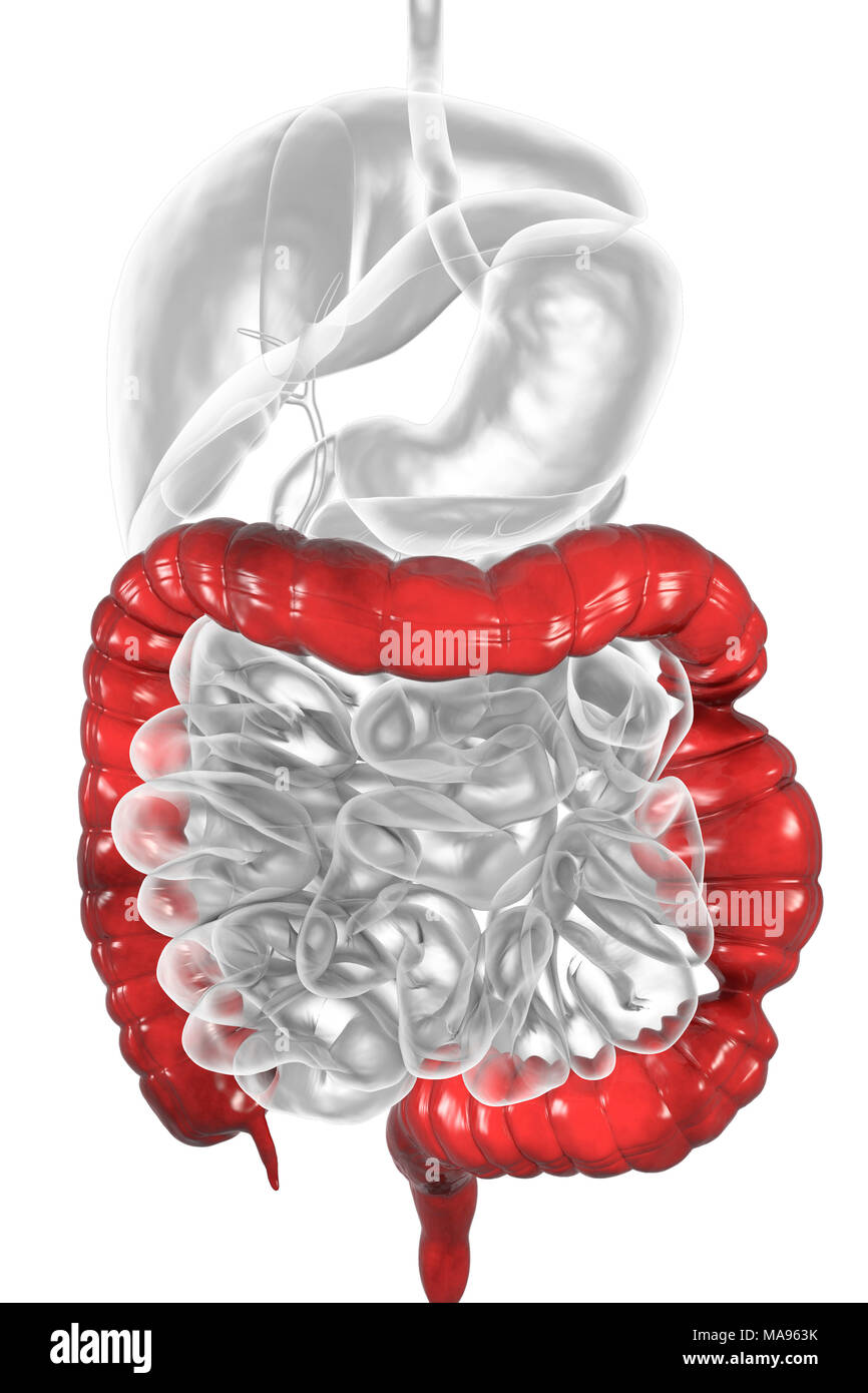Das Reizdarmsyndrom. Abbildung einer Magen-Darm-Leiden, das Reizdarmsyndrom (IBS). IBS ist auch als spastische Doppelpunkt oder reizbar Doppelpunkt-Syndrom bekannt. Es verursacht Bauchschmerzen und -krämpfe, und unregelmäßige Darmgewohnheiten wie Verstopfung und Durchfall. Der Zustand ist gedacht, um Angst und Stress, die unfreiwillige Muskelbewegungen im Darm stören verknüpft werden. Es gibt keine Heilung, aber Abführmittel, Mittel gegen Durchfall und krampflösend Medikamente können helfen, die Symptome zu lindern. Die Erhöhung der Aufnahme von Ballaststoffen und Wasser in der Ernährung, und abnehmenden Druck wird ebenfalls empfohlen. Stockfoto