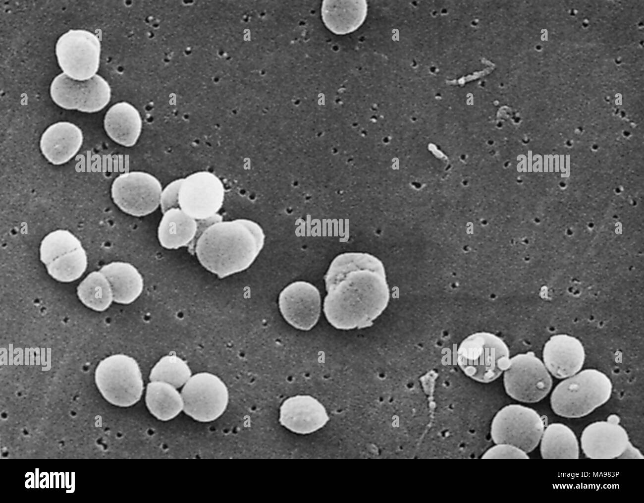 Gram-positiven Staphylococcus aureus-Bakterien in der Raster-Elektronen-Mikroskop (REM) Bild 2003 aufgedeckt. Mit freundlicher Seuchenkontrollzentren (CDC). () Stockfoto
