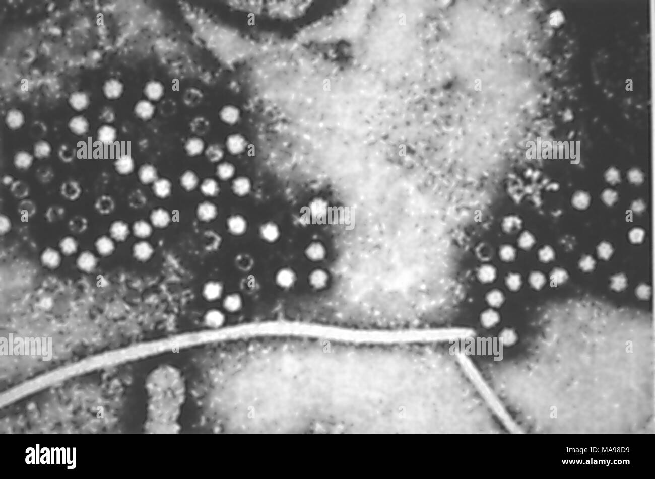 Hepatitis-E-Virus (HEV) Mitglied der Caliciviridae Familie, in der Electron Micrograph film, 2004 aufgedeckt. Mit freundlicher Seuchenkontrollzentren (CDC). () Stockfoto