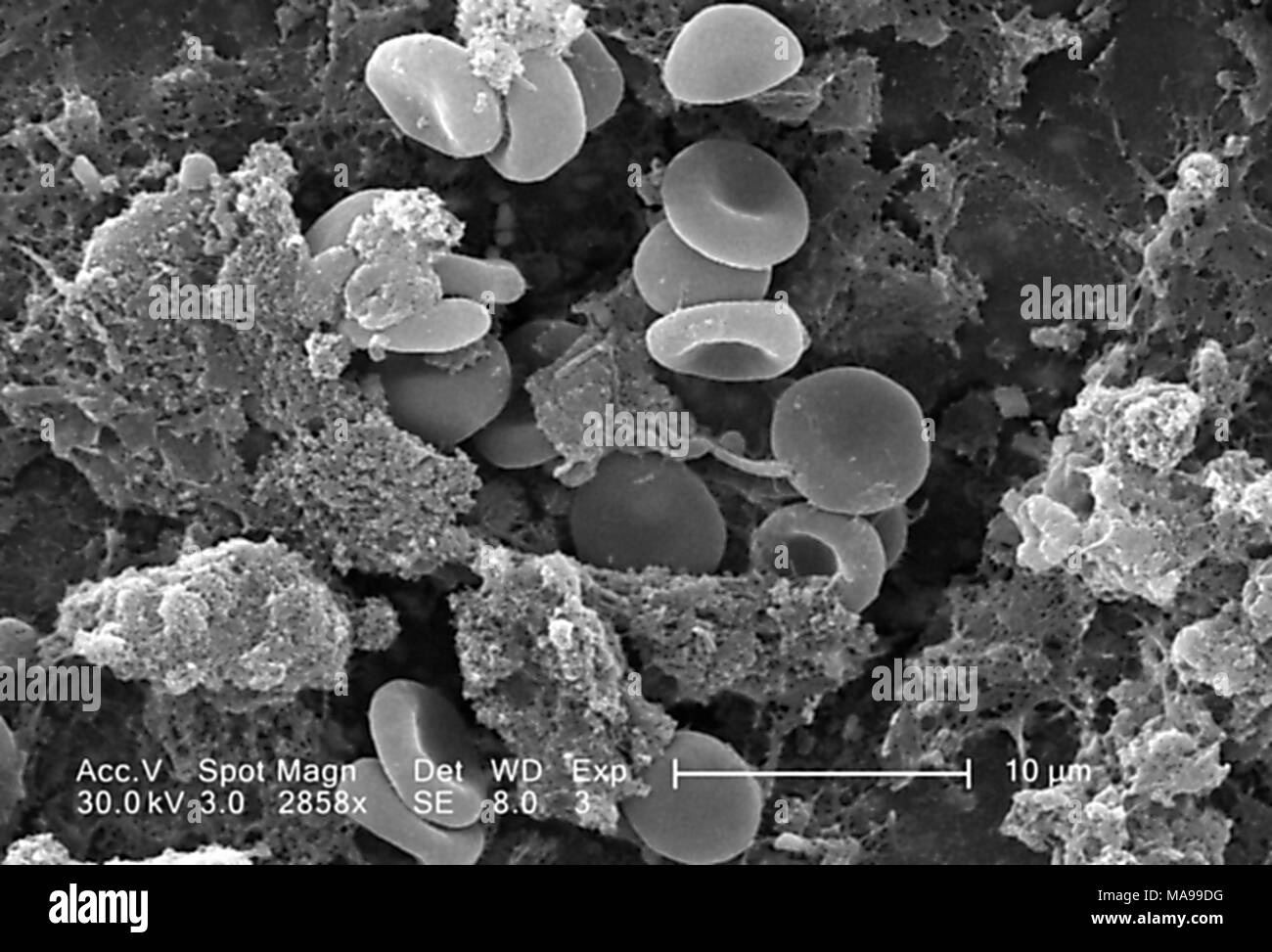 Die roten Blutkörperchen in einem Fibrinöse Matrix auf der luminalen Oberfläche eines Innewohnung Kreislauf-katheter im Raster-Elektronen-Mikroskop (REM) Bild 2005 aufgedeckt. Mit freundlicher Seuchenkontrollzentren (CDC)/Janice Haney Carr. () Stockfoto