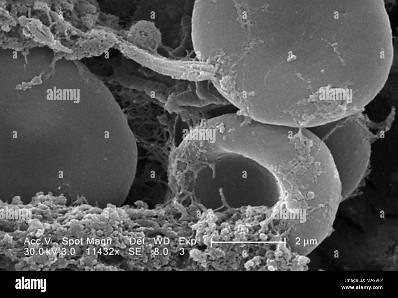 Rote Blutzellen auf der luminalen Oberfläche eines Innewohnung Kreislauf-katheter im Raster-Elektronen-Mikroskop (REM) Bild mit freundlicher Genehmigung Seuchenkontrollzentren (CDC)/Janice Haney Carr, 2005 aufgedeckt. () Stockfoto