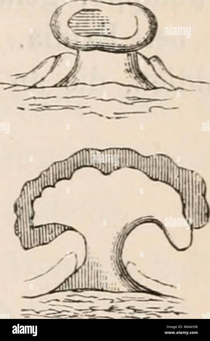 . Dr. L. Rabenhorst der Kryptogamen-Flora von Deutschland, Oesterreich und der Schweiz. Abb. 1. Guepinia helvelloides. Abb. Fruchtkörper in verschiedenem Alter (natürliche Grösse). Abb. 2. Basidie; (/ Tulasne). Naematelia. Fruchtkörper verschieden gestaltet, gefaltet und gefurcht, von derb-fleischiger Substanz, ringsum von dem dicken, gallertartigen Hymenium bedeckt. Abb. 1. 2. / Naematelia rubiformis (Corda). Abb. 1. Mehrere Frucht - Körper (natürliche Grösse). Abb. 2. Zwei solche vergrössert. Auricularia. Fruchtkörper Ohr- oder schüsselfönnig oder unregelmässig ausgebreitet, oft gelap Stockfoto