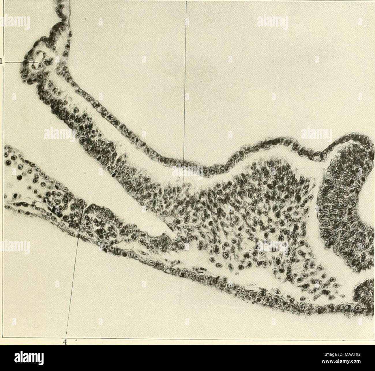 . Frühe Stadien der Vaskulogenese in der Katze (Felis domestica) mit besonderer Bezugnahme auf die mesenschymal Ursprung des Endothels. Bild ist! Transvci c Abschnitt; ui ciiihivd von zwölf Somiten Die amniotie Position der kaudalen Anlages des eta' V. umbilicalis zu sliow. Kolumbien ("ollee- Nr. 547, Folie 5, Zeile "J, Abschnitt 7, X-ilH). Keiluceil J.1 TTmbilical aufjiocyst 'J Amnion o Mesostnjnui I I'unnel - wie Divertikel der zölom zw.&lt;'en Schiffe von Th (^ splanchno - pleurc 73 Stockfoto