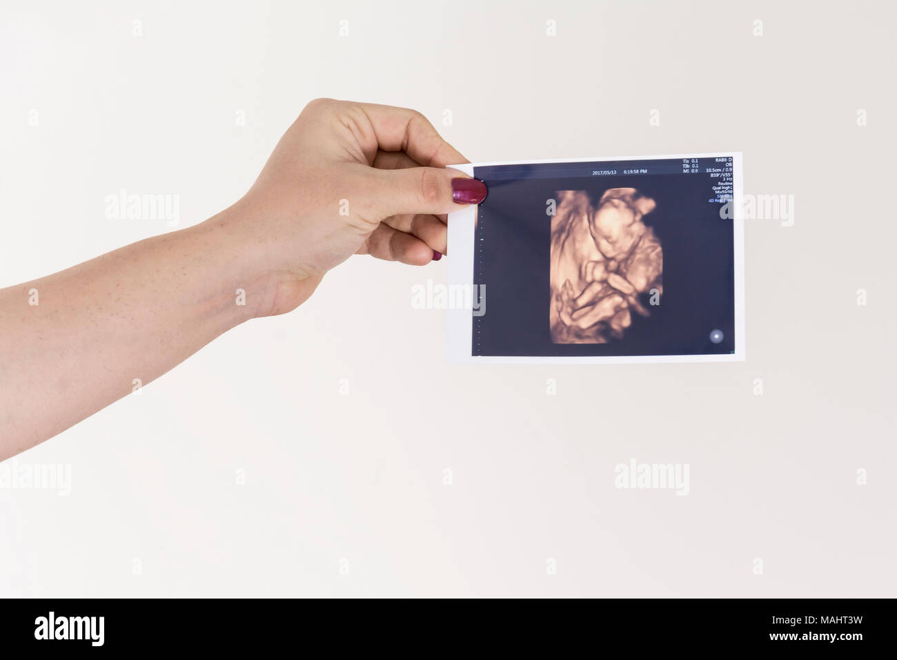 Mutter Holding unborn Baby Sonographie Bild in der Hand, vor weißem Hintergrund. kreatives Konzept. Stockfoto