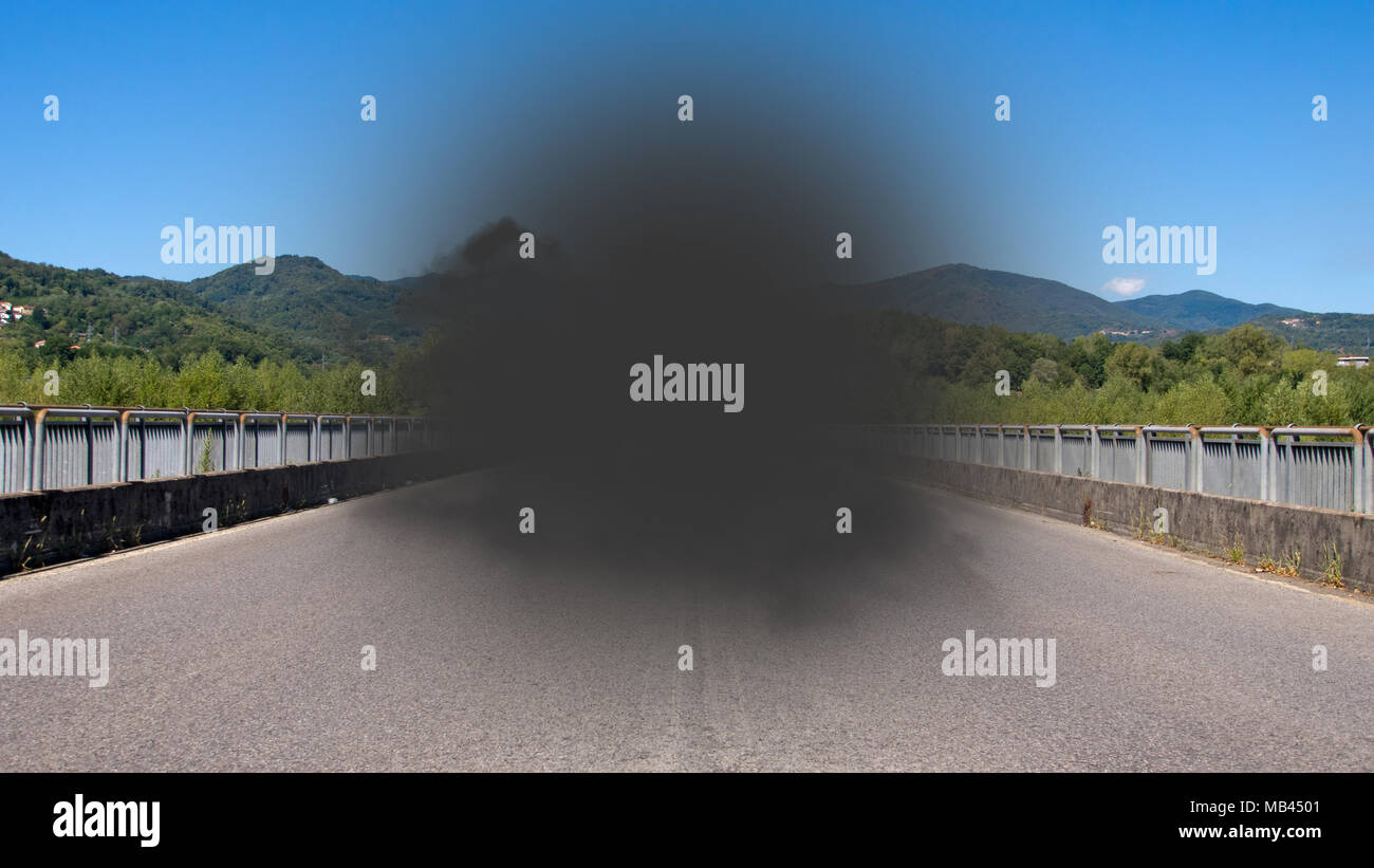 Makuladegeneration - Verlust des zentralen Gesichtsfeldes. Aka AMD, AMD. Alter. Stockfoto