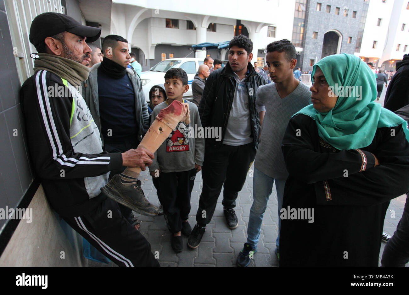 Gaza, Gazastreifen, palästinensischen Gebiet. 6 Apr, 2018. Ein palästinensischer Mann trägt Beinprothese Iyad Al Dawahidi ist nachdem er von israelischen Sicherheitskräften bei Zusammenstößen an der Israel-Gaza borde während einer Zeltstadt Protest das Recht, in ihre Heimat zurückzukehren erschossen wurde, bei al-Shifa Hospital in Gaza-stadt am 6. April 2018 Credit: Mahmoud Ajour/APA-Images/ZUMA Draht/Alamy leben Nachrichten Stockfoto