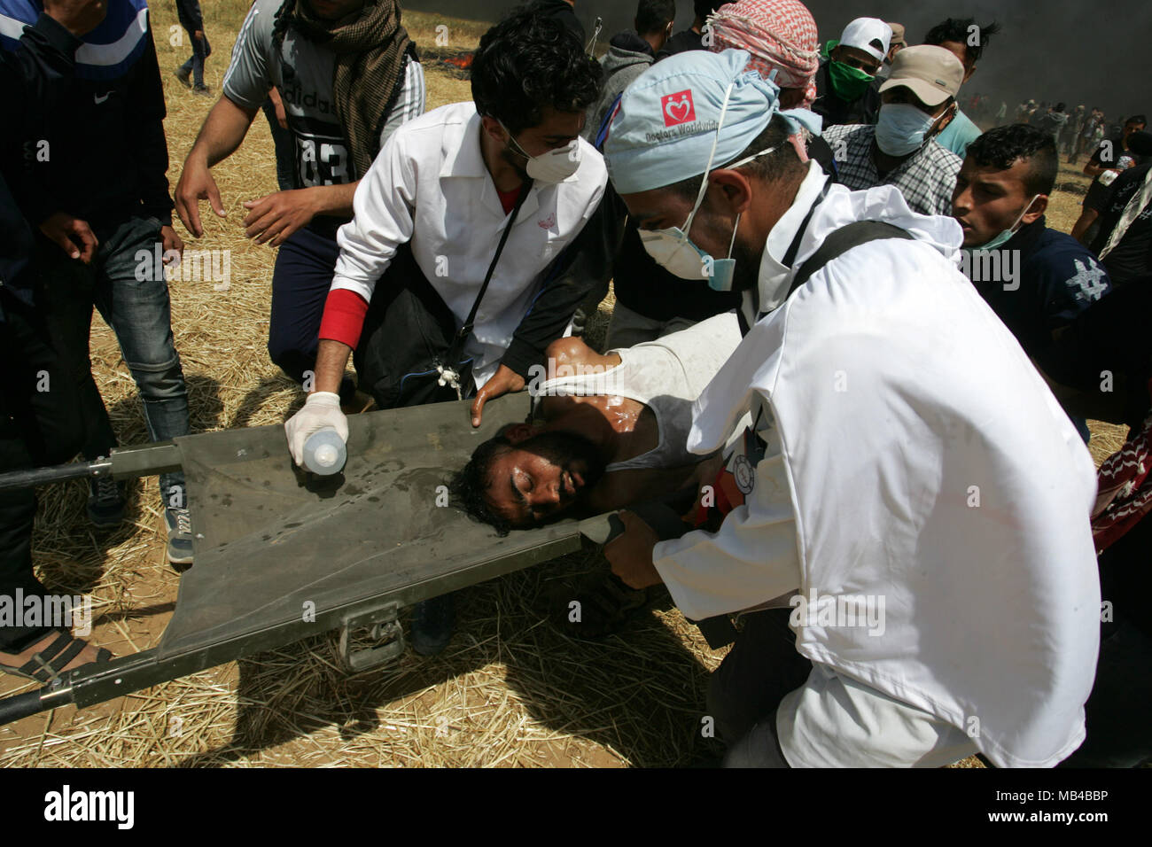 Gaza, Palästina. 6 Apr, 2018. Verletzt die Tendenz, bei Auseinandersetzungen mit der israelischen Sicherheitskräfte während Auseinandersetzungen auf der Gaza-Israel Grenze nach einem Protest, östlich von Khan Yunis im südlichen Gazastreifen am 6. April 2018. Auseinandersetzungen ausgebrochen auf der Gaza-Israel Grenze eine Woche nach ähnlichen Demonstrationen zu Gewalt in die israelische Gewalt getötet 19 Palästinenser, die blutigste Tag seit einem Krieg 2014 führte. Credit: Erwachen Foto Agentur/Alamy leben Nachrichten Stockfoto