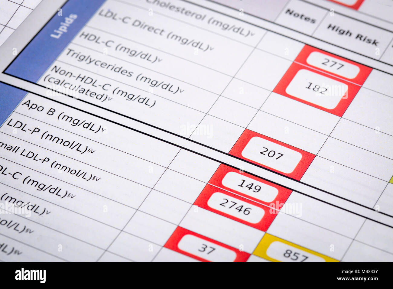 Red Flags für hohes Risiko Cholesterin - ein Detail von Blut Labor screening Ergebnisse mit Fokus auf Lipide Panel Stockfoto