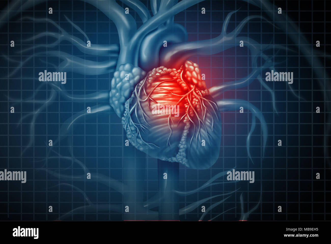Herzinfarkt Schmerz als menschliche Herz-Kreislauf-Orgel mit einer schmerzhaften Entzündung des Herzens mit 3D-Illustration Elemente. Stockfoto