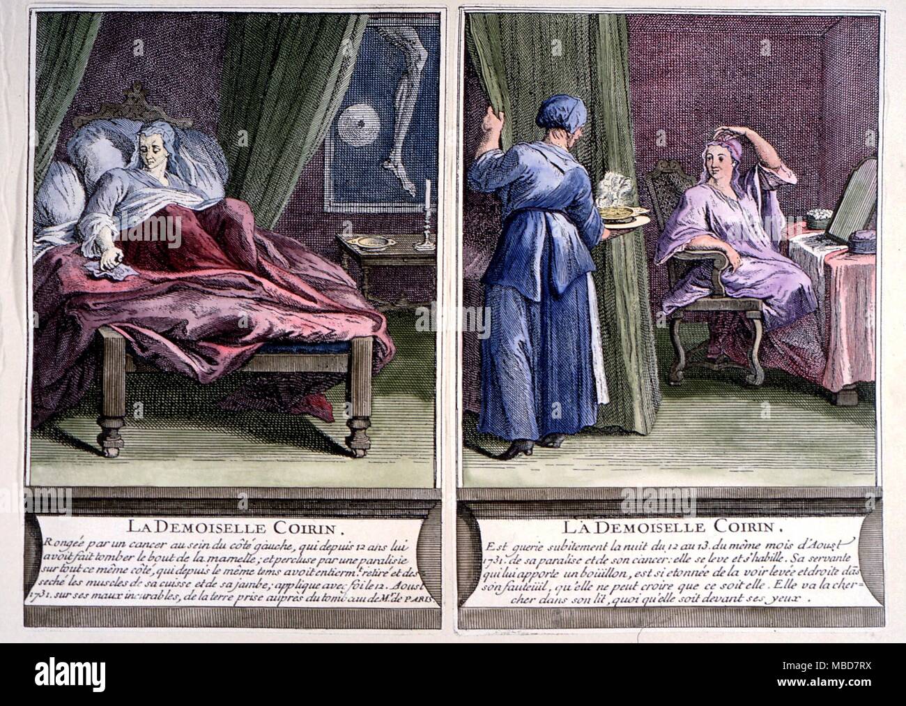 Merkwürdige Phänomene wundersame Heilung von Mlle Coirin durch Diakon Paris. Das Bild auf der linken Seite shnowns Coirin in Krankheit schmachtend, dass auf der rechten Seite zeigt ihr, wie durch ein Wunder geheilt. von C. de La Seigneurie 'La Verite des Wunder du Diacre Paris, 1737 Stockfoto