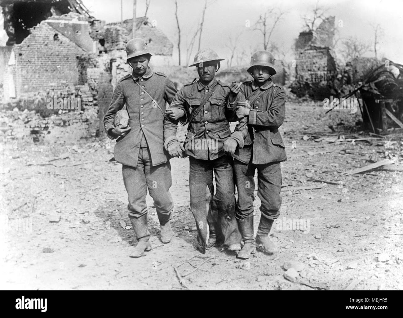 Первая мировая раненые. Британский солдат ww1 1917. Британские солдаты первой мировой войны 1914-1918.
