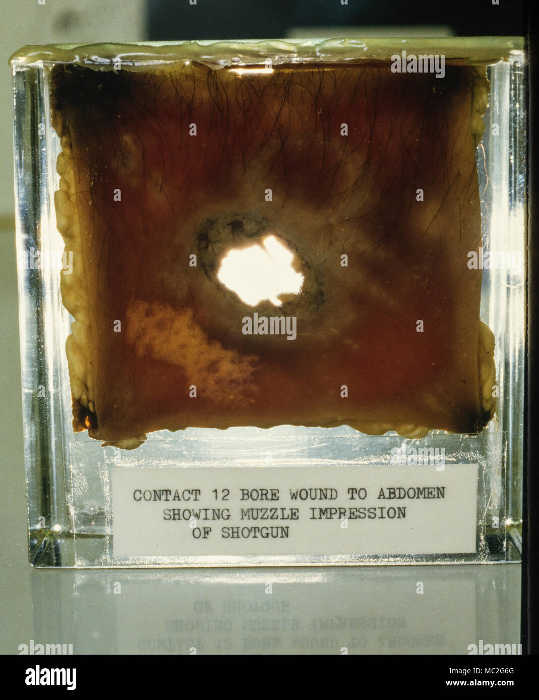 Scotland Yard Schwarz Museum Lambeth 1986 Kontakt 12 Bohrung Wunde, Abdomen, Schnauze Eindruck des Schrotflinte Fotos auf einem organisierten Presse Service Besuch mit Berechtigungen für die Forensische Abteilung in Lambeth London übernommen. Exponate gezeigt wurden durch den Besuch der Polizei aus Großbritannien und Übersee die forensische Arbeit von Scotland Yards forensische Untersuchungen Team umfangreiche kriminelle Fälle zu beurteilen. Die Exponate sind nun in Scotland Yard untergebracht und nicht für die Öffentlichkeit zugänglich. Stockfoto