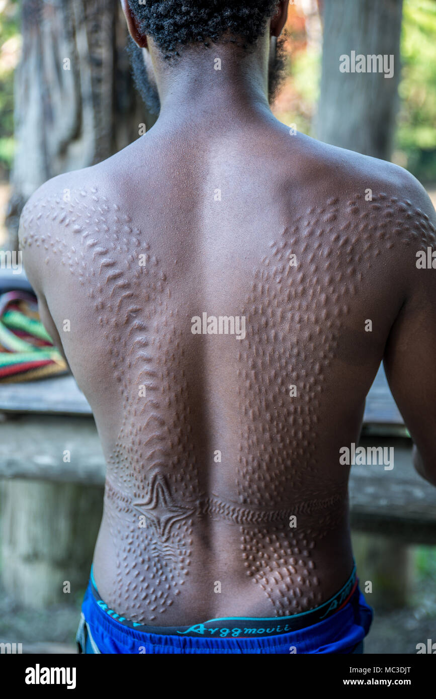 Narben auf dem Rücken eines Chambri Mann um zu schauen, wie Krokodilleder, Kanganaman Dorf, mittleren Sepik, Papua-Neuguinea Stockfoto