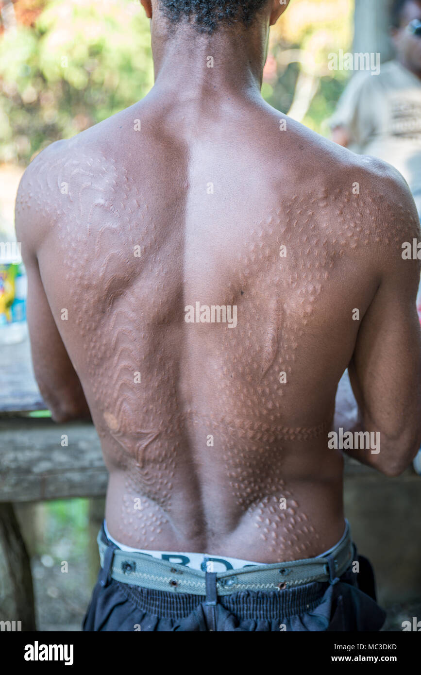 Narben auf dem Rücken eines Chambri Mann um zu schauen, wie Krokodilleder, Kanganaman Dorf, mittleren Sepik, Papua-Neuguinea Stockfoto