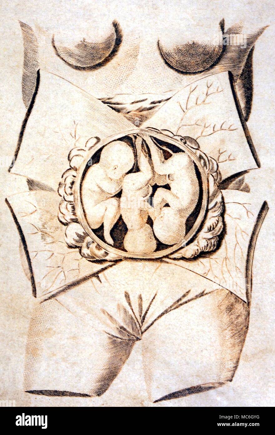 Medizinische - weibliche Gebärmutter mit EMBRYO Platte von "Culpeper's englischen Arzt und vollständige Kräuter', 1805 editon, herausgegeben von Vielleicht. Mehrere Geburt Stockfoto