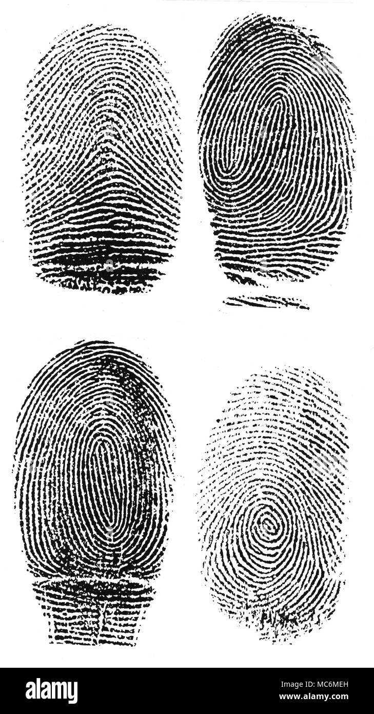 Handlesen - PAPILLÄREN BERGRÜCKEN die vier Arten von Papillären Muster auf die Finger. Top (Links) der Bogen Muster. Top (Rechts) die Schleife Muster. Unten (links) die längliche Wirtel, und unten (rechts) Der wirtel Muster. Stockfoto