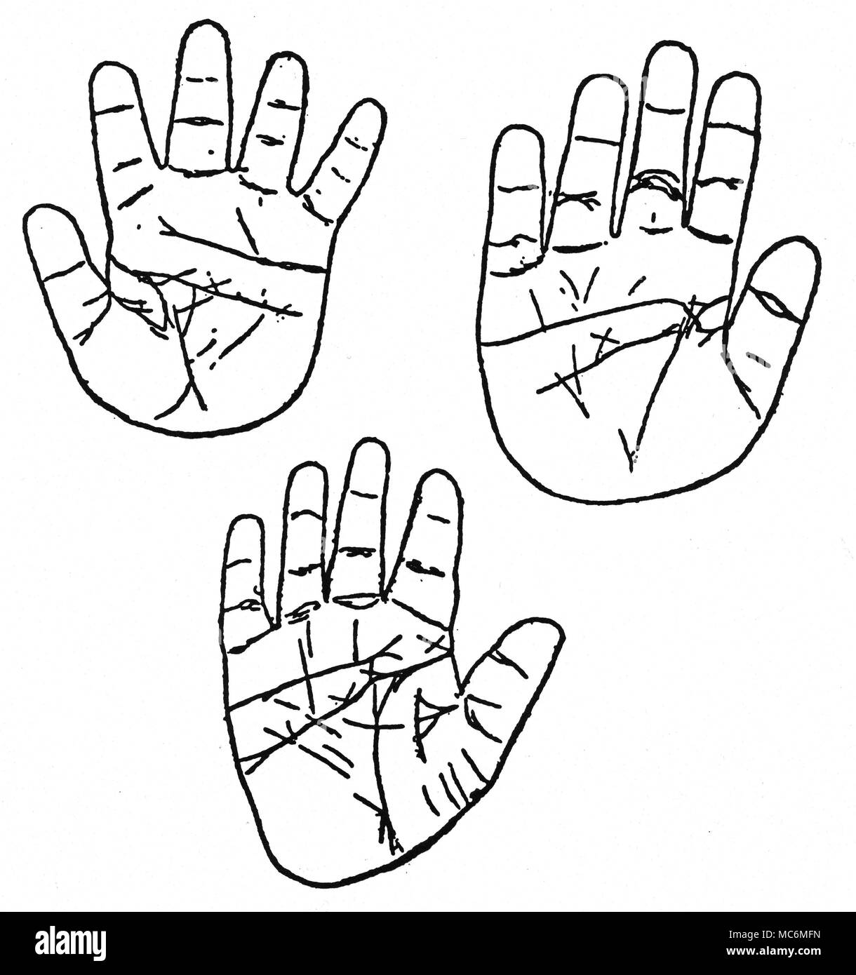 Handlesen eine Studie über die Beziehung zwischen den Händen der Kinder und Diphtherie, vom Englischen Handleser, Katherine St-Hill. Aus dem Magazin, die Handleser, für Dezember, 1893 Stockfoto