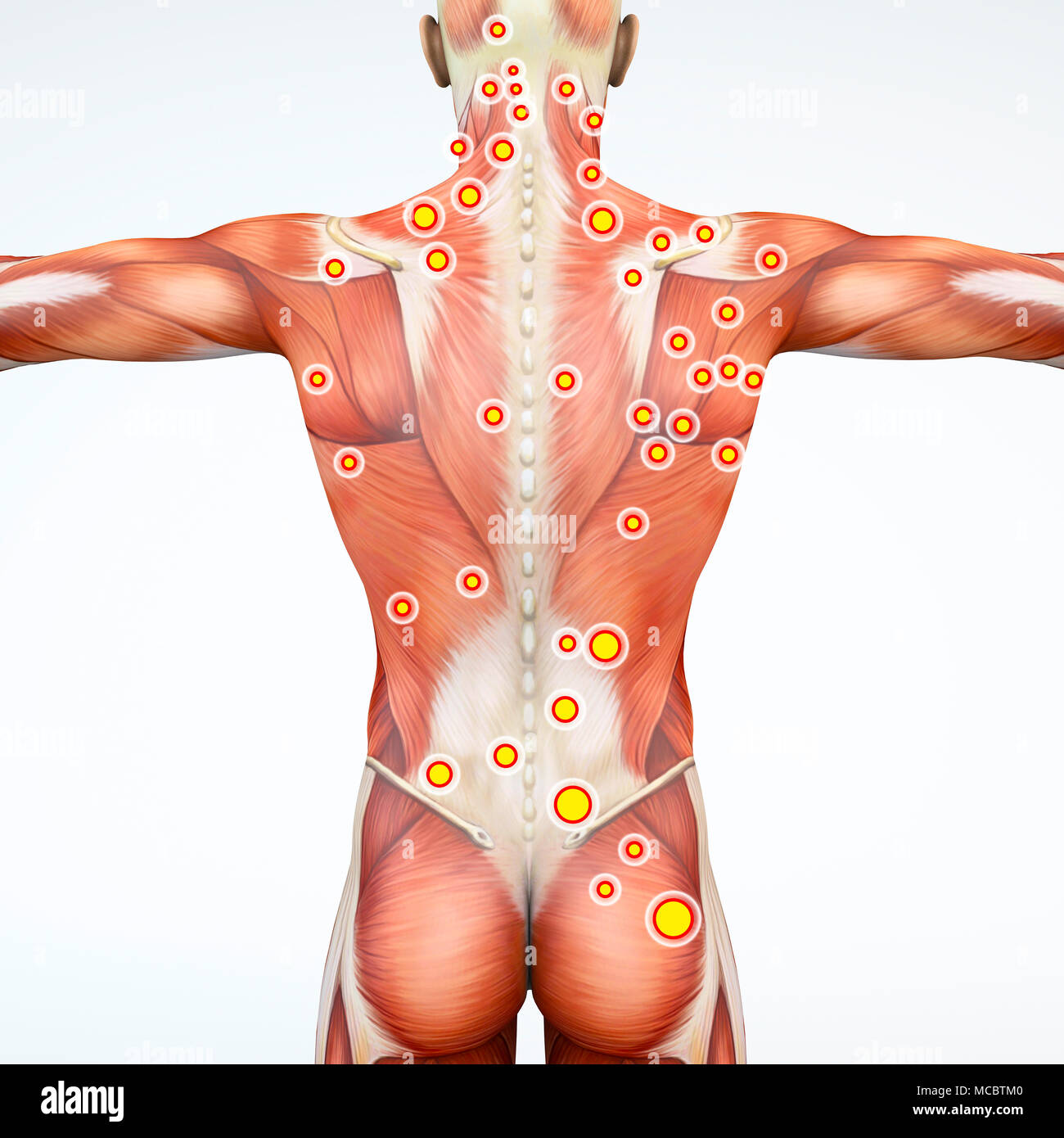 Zurück Blick auf einen Mann und seine Triggerpunkte. Anatomie Muskeln. 3D-Rendering. Myofasziale Triggerpunkte hyperirritable Flecken Stockfoto