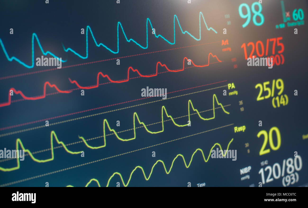 Monitor Herzfrequenz Beat Stockfoto
