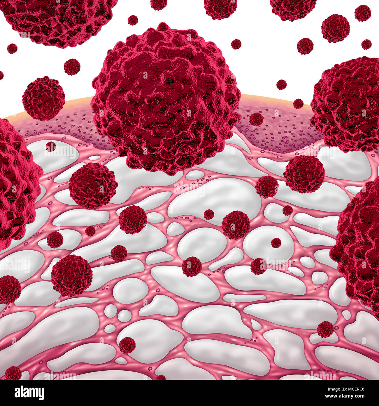 Interstitium und Krebs Konzept wie Bindegewebe mit comparments mit Flüssigkeit als mikroskopische konzeptionelle menschlichen Körper Teil mit bösartigen cel gefüllt Stockfoto