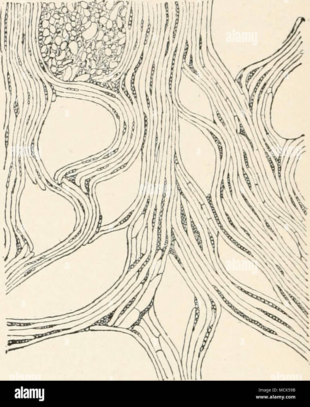 . Abb. 227.-Abschnitt einer neunjährigen Zweig des Juniper von &Amp angegriffen;'!/ (/t} iospo)'aH (7 iM?) t. Die Rinde unter der spore-Kissen ist viel verdickt; das Holz auf der gleichen Seite ist viel von Flächen des Parenchym gebrochen. (Nach Woernle.) Abb. 228.- Tangentialschnitt througii krankes Holz unter einer Spore-Kissen. Das Holz - Elemente sind wesentlich durch abnorme Landstriche Parenchym verdrängt. (Nur einer der letztgenannten gefüllt wurde, können die anderen leer gelassen.) (nach Woernle.) Der Twig - bewohnen Form ist durch ein vermehrtes Wachstum der kortikalen Zellen als zur Erhöhung der Bast-Parenchym; Im nee Stockfoto