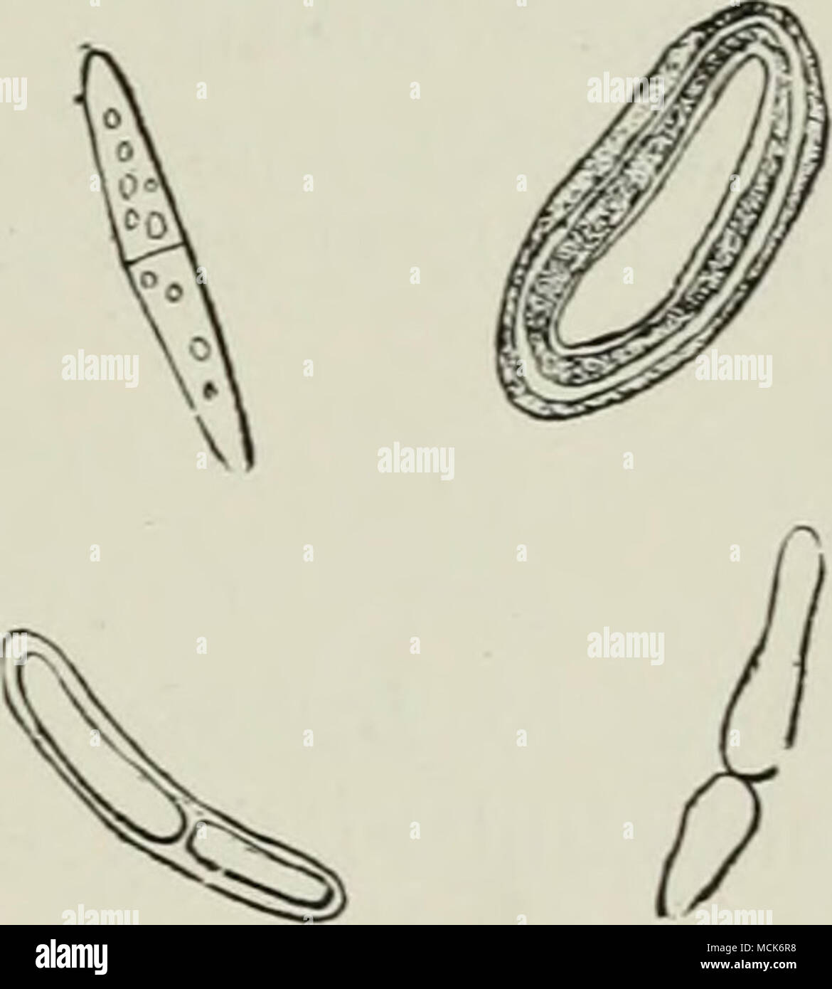 Abb 116 Ahypoderma Strobicola Auf Pinus Strobiis Ascus Mit Acht Ascosporen A Mit Gelatineartigen Mantel Paraphyses