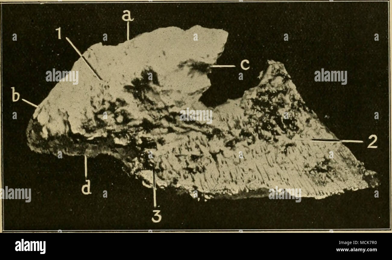 . Abb. 16.- Außenfläche der äußeren seitlichen Knorpel. 1, externe Gesicht des Knorpels - (a) der oberen Grenze, {b) Die posteriore Grenze, (c) der vorderen Rand, (d) die untere Grenze; 2, die Os pedis; 3, Flügel von OS Pedis. im Zusammenhang mit dem Betrieb für quittor erinnert. Unter und hinter, der Innenseite der Knorpel ist die plantare Kissen united. Die obere Grenze, manchmal konvex, manchmal gerade, ist dünn und abgeschrägt, und kann leicht in das lebende Tier zu spüren. Es ist diese Grenze, die den Digitalen Schiffe überqueren Sie den Fuß zu gewinnen, und die Grenze ist oft von einer tiefen gebrochen Stockfoto