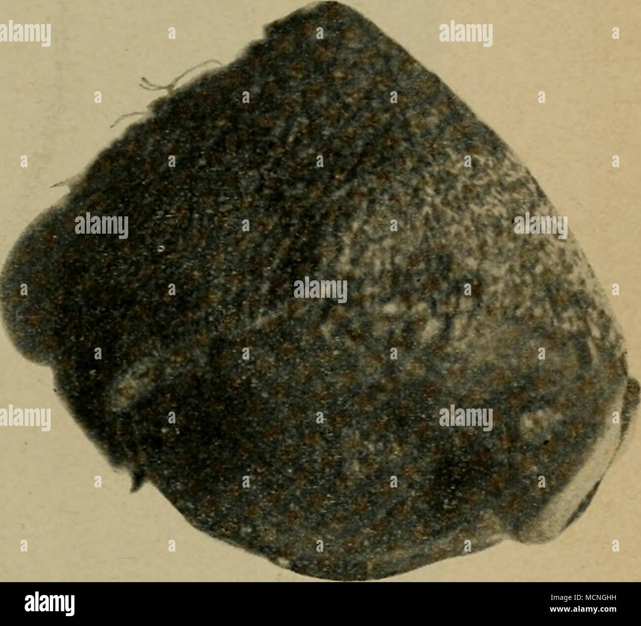 . Rinde. Angeborene warzige Neubildung. Naevus verrucosus. (Eigene Beobachtung.) Melanofibroni des Kalbes. Ungeheure Neubildung bei einem sehr jungen Tiere. Die Abbildung stellt nur ein kleines Stücli dar. Ihr Browser kann leider keine eingebetteten Frames ist Sterben tief schwarz gefärbte, schnell ganz haarlose Haut sicht-bar; unten eine völlig schwarz erscheinende Clemens - gewebige Schnittfläche. Noch mehr entspricht dem Bilde des Naevus verrucosus Löwen mit dem Berliner Schlachthofe bei einem sehr jungen Kalbe beobachtete Hautaffektion ausgedehnte, von der mir ein Stück (Abb. 99) zur Verfügung gestellt wurde. Aus dem Miß-Verhältnis des ändert sich d Stockfoto
