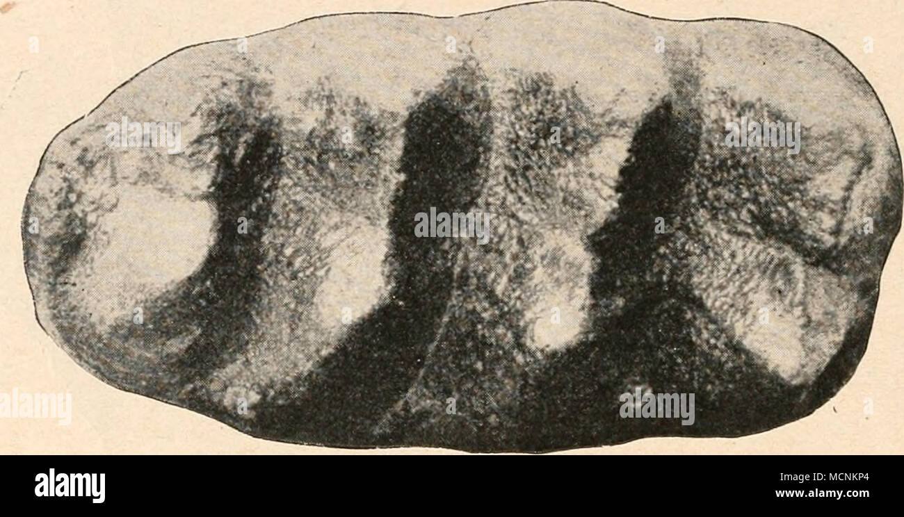 . Abb. 623. Molar von Mastodon brevidens, bewältigen, aus dem Oberpliozän von Montana (Nordamerika). 1/2 Nat. Gr. (/ M. Pavlow.) auch P2. Im Verlaufe der Stammesgeschichte Stachel bei den Ele-fanten Alle Prämolaren des Ersatzgebisses verloren und es bleiben nur mehr sterben Milchmolaren übrig, denen auch sterben Ou als,, bleibende" bezeichneten Mahlzähne Molaren des fertigen Gebisses erwachsener Säuge- tiere angehören. Ursprünglich stehen sterben Backenzähne nebeneinander in einer Reihe und gleichzeitig funktionieren. Mit dem Größenwachstum der Zähne und der Verkürzung der Kiefer ändert sich stirbt aber Stockfoto