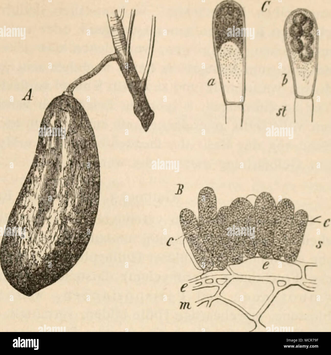 . Abb. 140. (B. 748.) Pilz, Taschen oder Narren der Pflaumenbäume (Exoasus - Pnini Fkl.) Ein eine Tasche in natürlicher Grösse. B-Durch-schnitt durch den oberflächlichen Theil einer solchen. Sterben Mycelfäden tu haben zwischen der Epidermis •: und der ab-gehobenen Cuticula c eine Anzahl Schläuche s gebildet, in denen noch keine Sporcnbiklung eingetreten. CZwci Sporen-Schläuche ab mit der Stielzelle st, stärker vergrössert, bei einem noch unreif, bei b mit 6 Sporen im Innern. Aus Fra.nk-Handbuch. Familie 3. Gymnoasci Winter. Vor den Saccharomyceten undExoasci dadurch ausgezeichnet, dass das Mycel Stockfoto