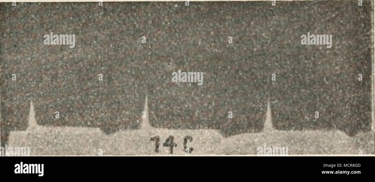 . Abb. 267 a-C. Aktionsströme des ungleich temperierten Kapillarelektm Froschherzens (Meter). / V. Kries. Ableitung von Basis und Spitze der Kammer. Bei einem Ist-sterben Grundlage kälter; bei b absichtliche Erwärmung der Spitze; bei c Abkühlung der Spitze. Von links nach rechts zu lesen. 1 Boruttau, Arch. w. Anat. u. Figura Figura. Abt., 1913, S. 525; Festschrift für Hermann, 1908, S. 181. 2 Samojloff, Arch. f. d. Ges.. Kurt von Figura, 135, S. 441 und 1910. 3 Nicolai, Zentralbl. w. Kurt von Figura, 26, S. 108; 1913. Vgl. auch Samojloff, 16* Stockfoto